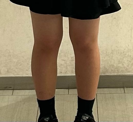 カエデ　足元太くて短いです‼︎ 至急この足は太いですか、スカートはいてて大丈夫ですか正直にお願