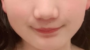 垢抜けたいです教えてください この顔垢抜けない顔