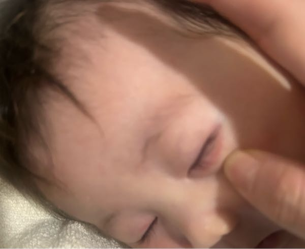 生後2ヶ月赤ちゃん これはアトピーの症状ですか？ 外に出たら目を掻き出して瞼が赤くなりました 左は下瞼、右は上瞼に赤くなって炎症が起きてます