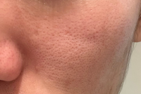 ニッキースキンクリアNikki'sskinclearについて - Yahoo!知恵袋
