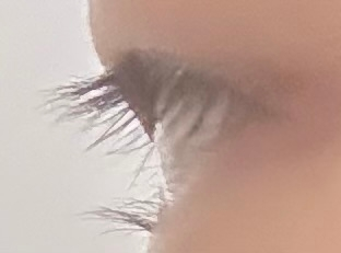これって逆まつ毛ですか？