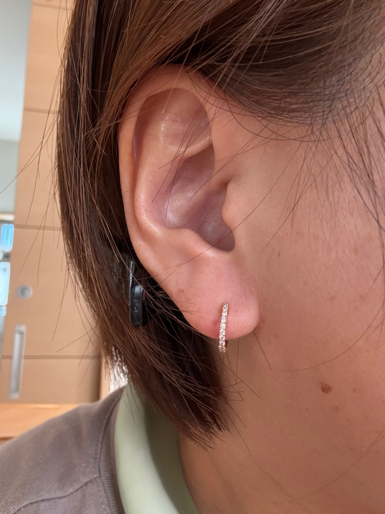 フォワードヘリックスにピアスを開けましたが失敗でしょうか