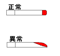 たばこに火をつけるとき うまくいかず 斜めに火が広がってしまう この状態 Yahoo 知恵袋