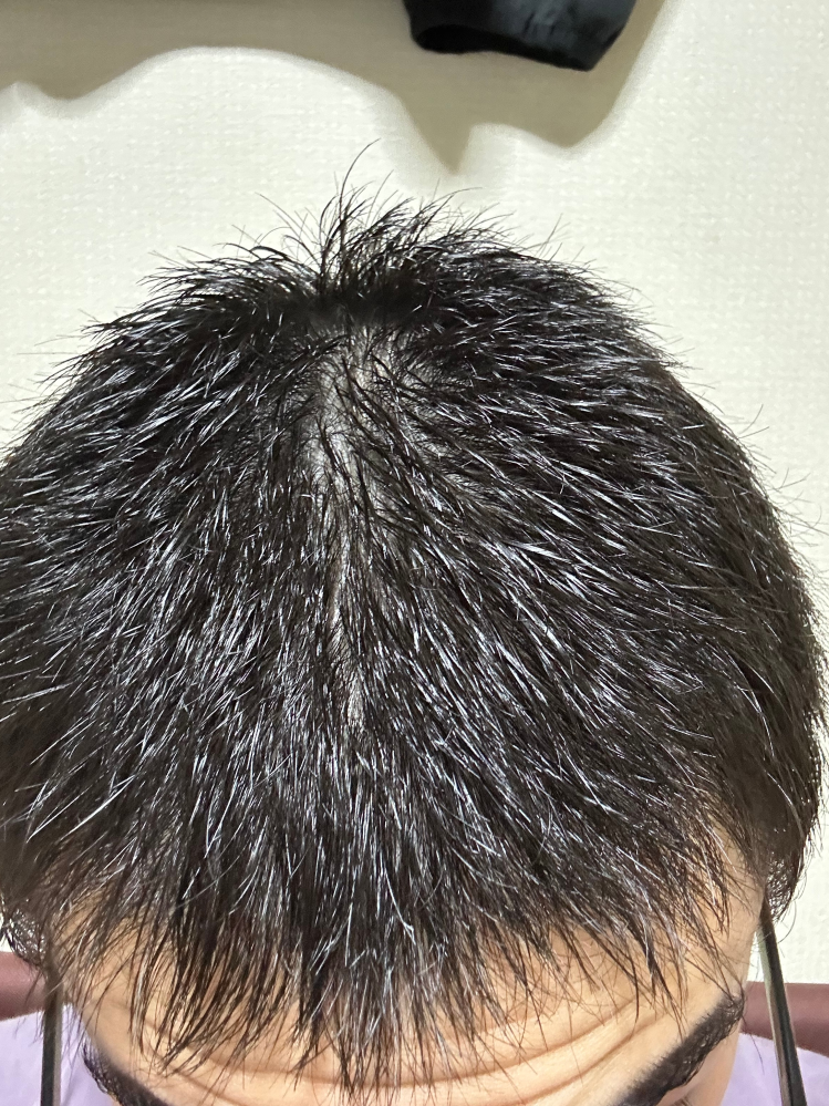 くせ毛坊主 これってくせ毛ですかね？坊主の伸びかけです - Yahoo!知恵袋
