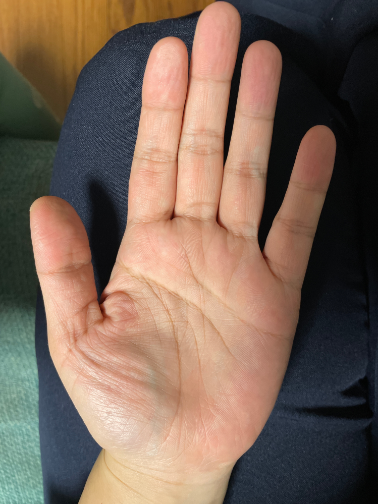 手相について質問です。左手の生命線より内側に沿うような形で斜め