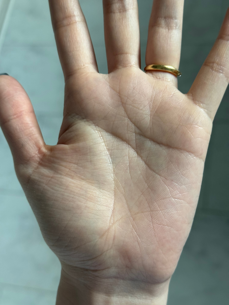 手相について質問です。生命線に島のような形があり、「病気になる