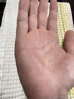 手相鑑定して頂きたいです。 男です。太い結婚線が1つあります。下に細い結婚線2つあります。現在アラサーで細い結婚線は当たってたと感じるのですが、結婚線が無い歳の恋愛は全然うまくいきませんでした。太い線は35歳を指していると思われるのですが、それまで彼女はできないのでしょうか？よろしくお願いします。