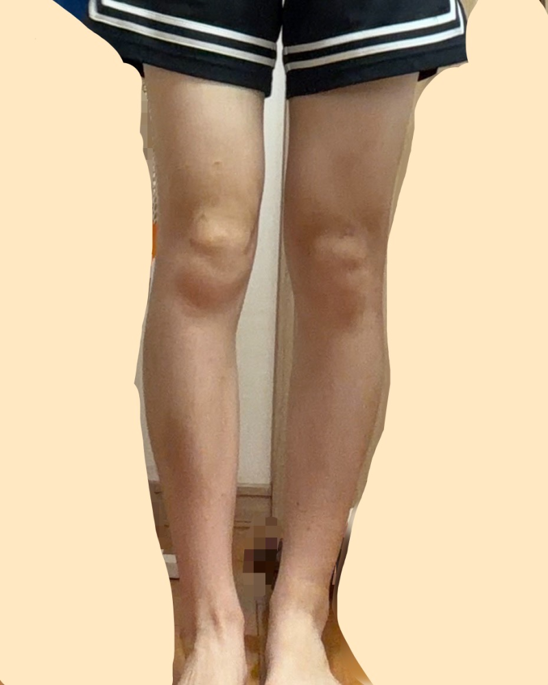 これって足太いですか？ミニスカとかショートパンツとか履くのが少