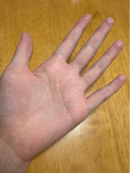 生命線がめっちゃ短いです手相占いお願いします！※おふざけの勘と
