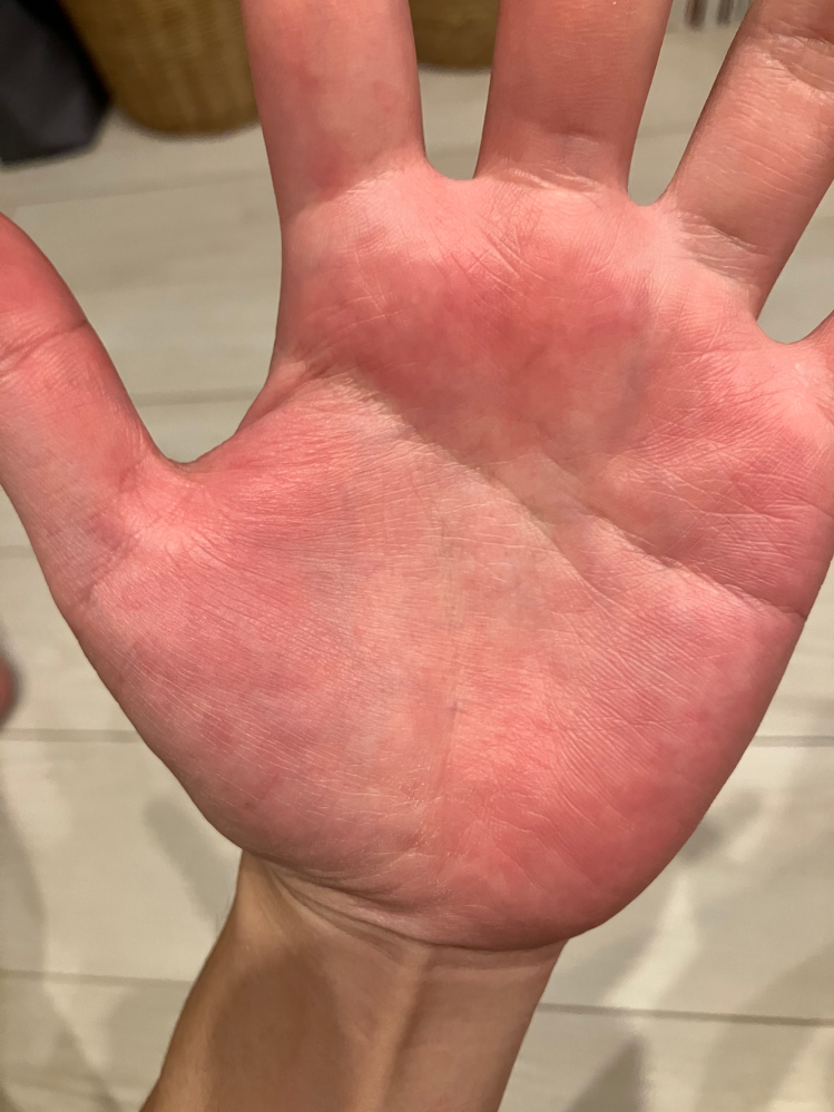 手相占いをお願いします - お写真を拝見しました。全体的に拝見