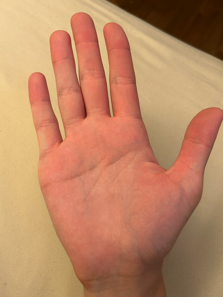 手相を見てほしいです。以前から、自分の手相が他の人と少し違うように