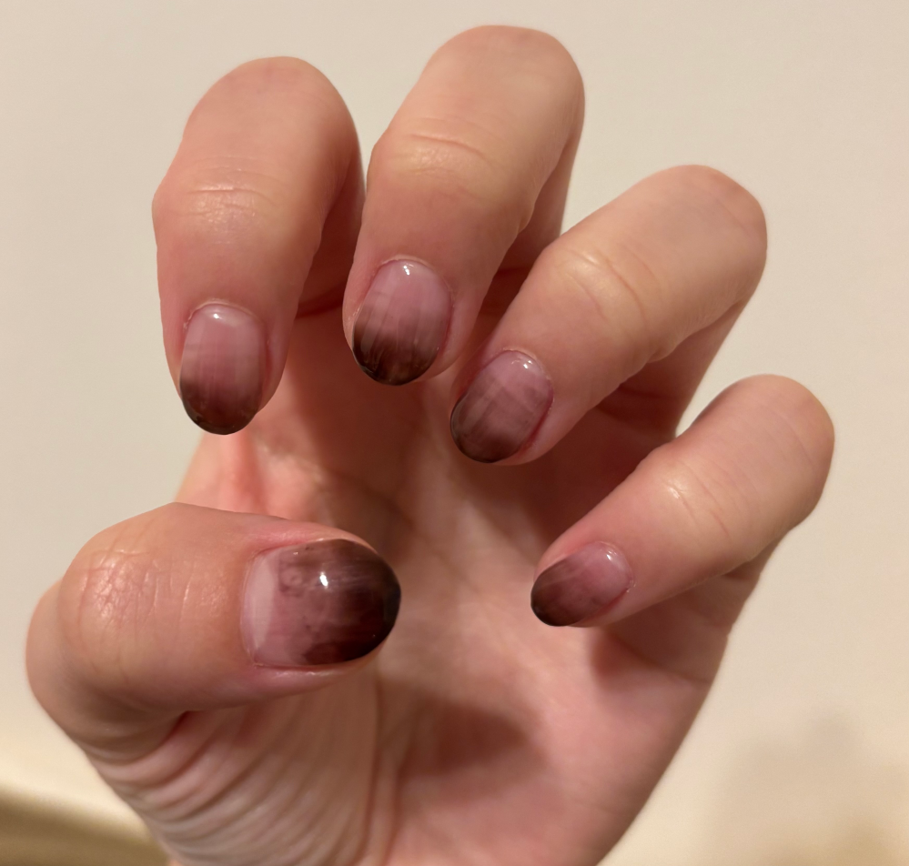 JNEC認定モデルハンドについて質問です。みなさん骨折と言って