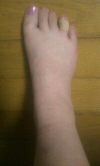 足の幅がひろすぎて困っています 見苦しく載せるような写真ではな Yahoo 知恵袋