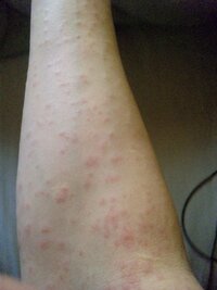 画像があるので気持ち悪い方は見ないで下さい 私は19歳の女なんですが２週 Yahoo 知恵袋