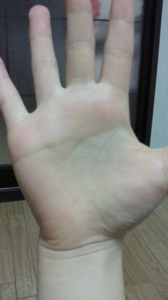 私の手相は 両手ますかけ線 で珍しいと聞いたのですが どういうことが Yahoo 知恵袋