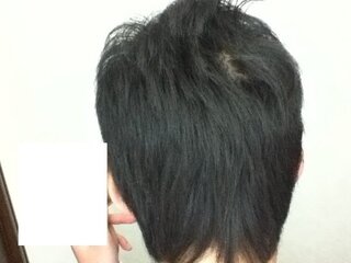 つむじの形と場所が変で髪がハネまくります の写真は後ろから撮ったも Yahoo 知恵袋