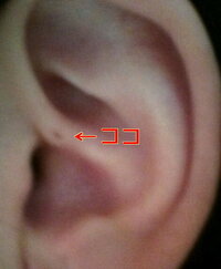 私は両耳の軟骨部分に小さな穴が開いています 画像参照 自分では確認する Yahoo 知恵袋