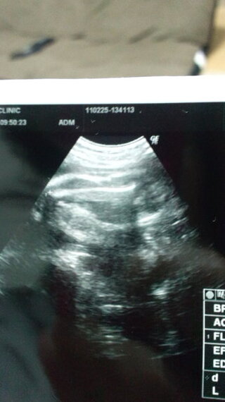 赤ちゃんの性別について このエコー写真から男の子か女の子か解りますか 太 Yahoo 知恵袋