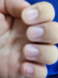 これは深爪なのでしょうか あなたはどう思いますか 写真付 先 Yahoo 知恵袋
