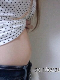 ビキニを着るときに お尻や太ももに肉割れがあったらどうしますか Yahoo 知恵袋