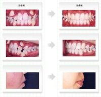 八重歯が好きなフェチ マニアへ 八重歯のどこがいいのかな 画像をみても矯 Yahoo 知恵袋