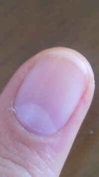 爪の白い部分とピンクの部分の境目が ４月から高校生になるもので Yahoo 知恵袋