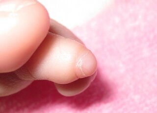 70以上 赤ちゃん 足の爪 丸まる マウスパッド アニメ