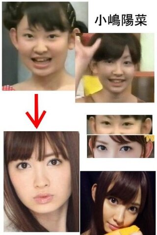 こじはること小嶋陽菜は整形ですか ａｋｂ４８前田敦子卒業大島優子渡辺麻友 Yahoo 知恵袋