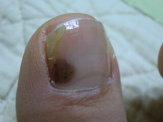 映画 談話 パッチ 足 爪 茶色 Soba Yumeji Jp