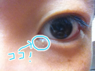 画像あり なんか 目のところに白いものができました 大きいやつは2 3ヶ Yahoo 知恵袋