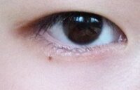 まぶたの脂肪はダイエットで取れますか 現在ダイエット中で 順調に徐々 Yahoo 知恵袋