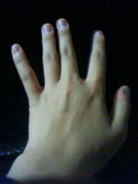 至急 手がでかい ごつい 私の手は写真のようにご Yahoo 知恵袋