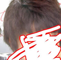 髪の毛が5mmくらいからこの写真くらいまでエレンス01やヘアアクセルレ Yahoo 知恵袋