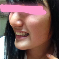 歯並びと顎の形について 横顔と歯の写真がありますので注意 口から下がし Yahoo 知恵袋