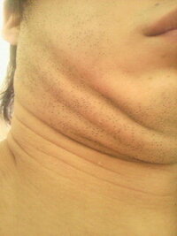 至急で回答よろしいでしょうか 顎を引くと この様になります 皮膚 Yahoo 知恵袋