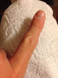 ギターのセーハをするのに困っています。
ギター歴は10ヶ月くらいです。
今までは、FやＦm7などそれぞれフォームを変えて演奏していましたが、きちんと全部の弦が押さえられた方が良いと思い、練習をはじめま した。
いろんな動画を見たりして、かなり練習しています。
しかし人差し指の側面が写真のようにボコボコして、きちんと押さえられません。
また動画や友人から後々を考えると人差し指のなるべく先で6弦...