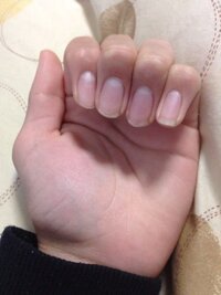 これ僕の爪なんですけど これって形いいほうですか あ 白いとこ Yahoo 知恵袋
