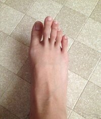 画像あり私の足の指です長すぎて気持ち悪いですよね最近急に手足の指 Yahoo 知恵袋