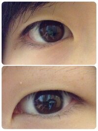 アイプチで一重または奥二重から 二重になったという人質問です Yahoo 知恵袋