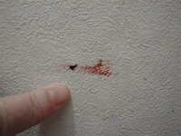 壁紙に血の塊りを擦り付けた様なものが付きます 最初はトイレだけだ Yahoo 知恵袋