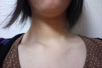 髪はねを直す方法を教えてください 画像の通り片方の髪だけ異常に外はねし Yahoo 知恵袋