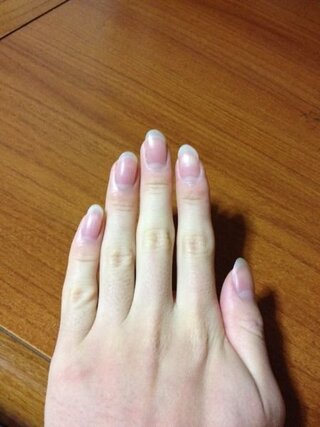 男性ですが 男なのに縦爪っておかしいですかね 昔からよく言われます Yahoo 知恵袋