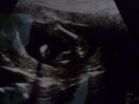 性別判定お願いします 妊娠16週のエコー写真です 見にくいですが男の子か女 Yahoo 知恵袋