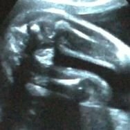 妊娠８ヶ月です このエコー写真で 性別は分かりますか Yahoo 知恵袋