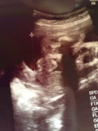 エコー写真つきです 妊娠9ヶ月 32週目 の妊婦健診で先生に性別を聞い Yahoo 知恵袋