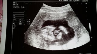 妊娠16週でほぼ男の子と言われました エコー写真で写ってるからと Yahoo 知恵袋