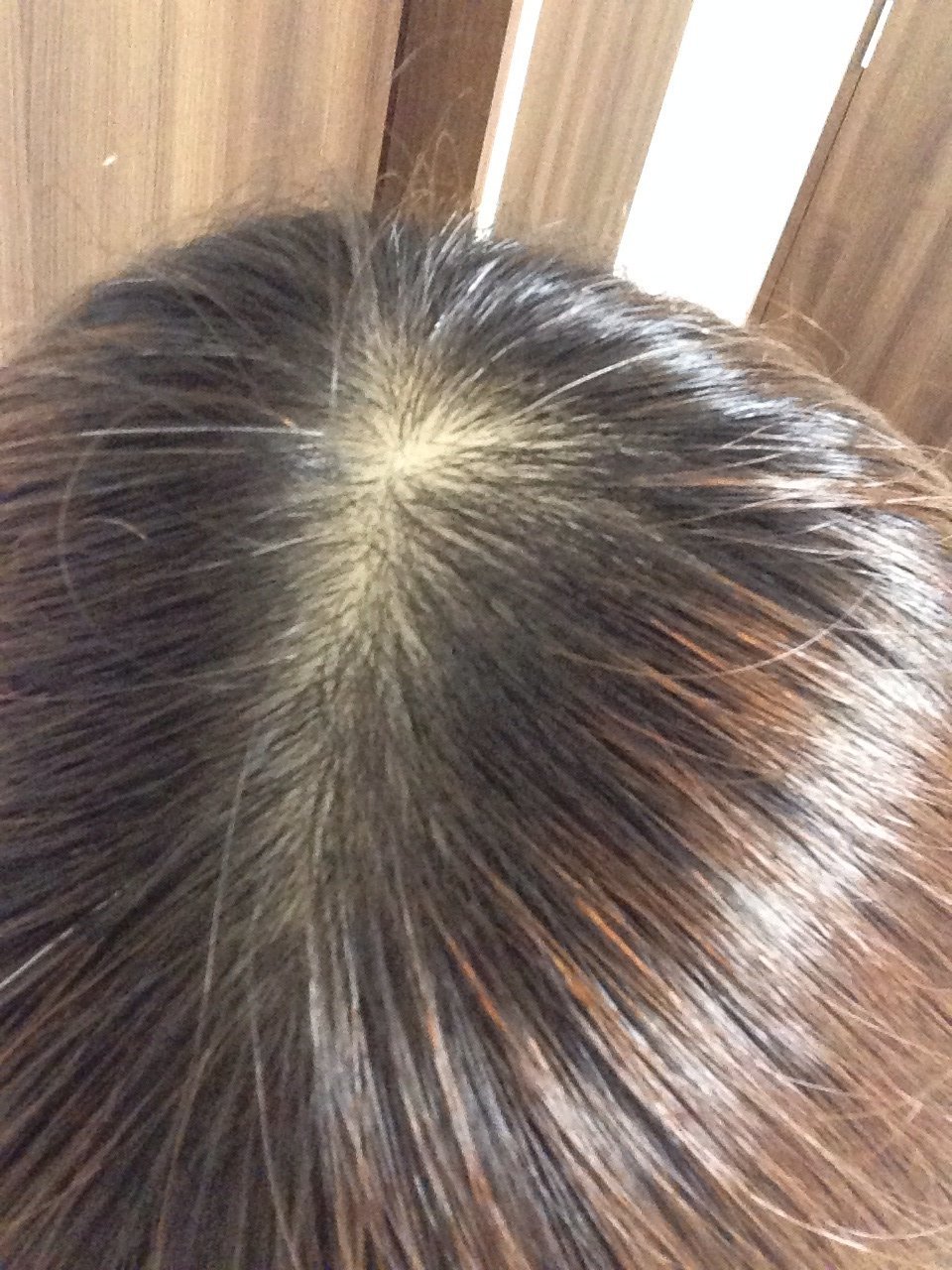 良い 抜け毛 悪い抜け毛