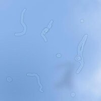 時々白い線 みたいなのが視界に入ってきます 何個も何個も見えて時間が経てば Yahoo 知恵袋