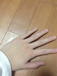 中学生女子です 私は今 手について悩んでいます 自分の手がコンプレックスで Yahoo 知恵袋