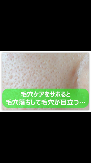 毛穴についてです 頬の毛穴の開きが気になります 画像は拾い画ですがこ Yahoo 知恵袋